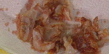 салат с картофелем, беконом, фасолью и яйцами пашот