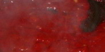 бурчак шурпа