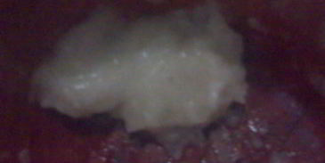 маринованная свекла по-грузински