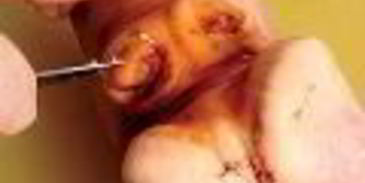 холодец гояжьей рульки и копыта